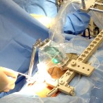 Robotics-Endoscopic-Spine-Surgery3